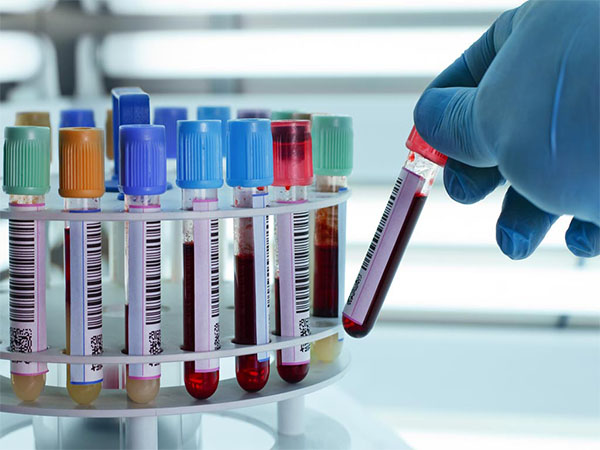 Toma De Muestras Laboratorio